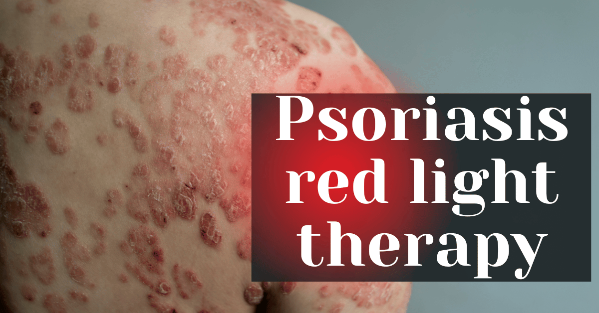 Psoriasis red light therapy