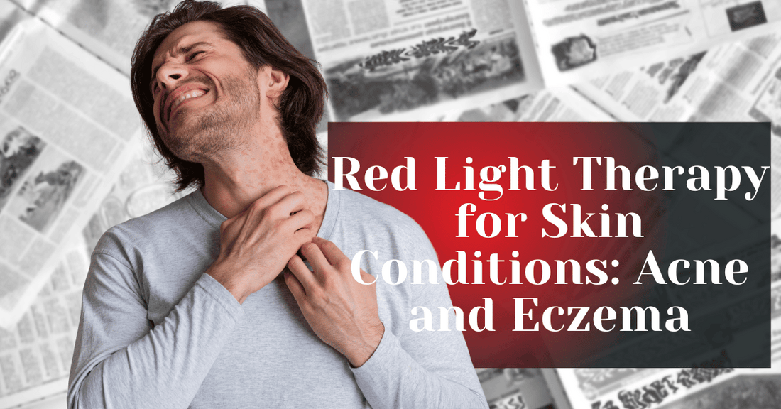 Red Light Therapy for Skin Conditions Acne and Eczema