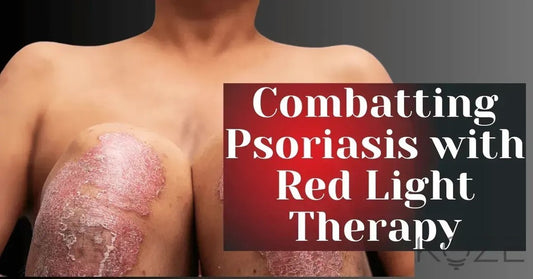 Supplements for Psoriasis: What You Need to Know