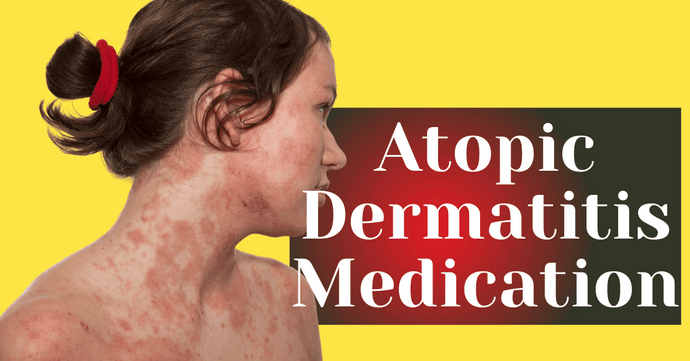 Atopic Dermatitis Medication