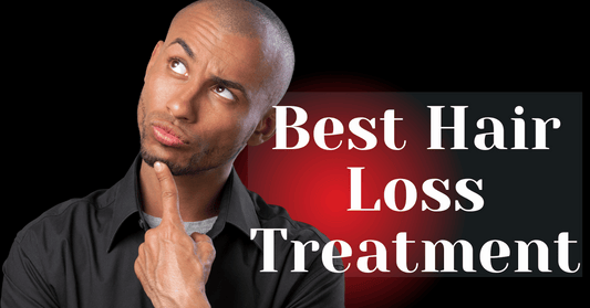 Best Hair Loss Treatment