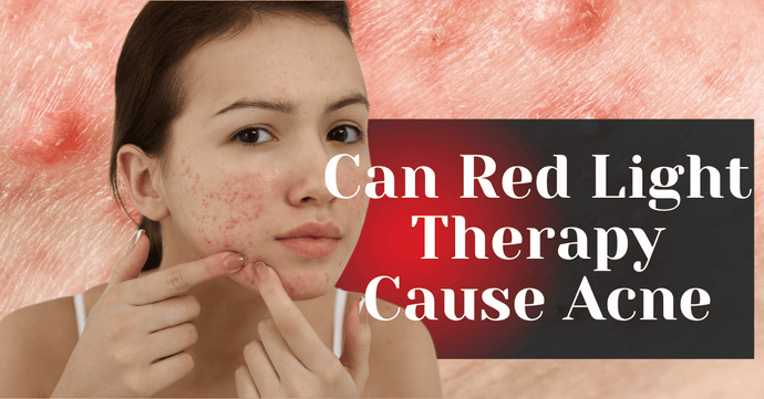 Can Red Light Therapy Cause Acne