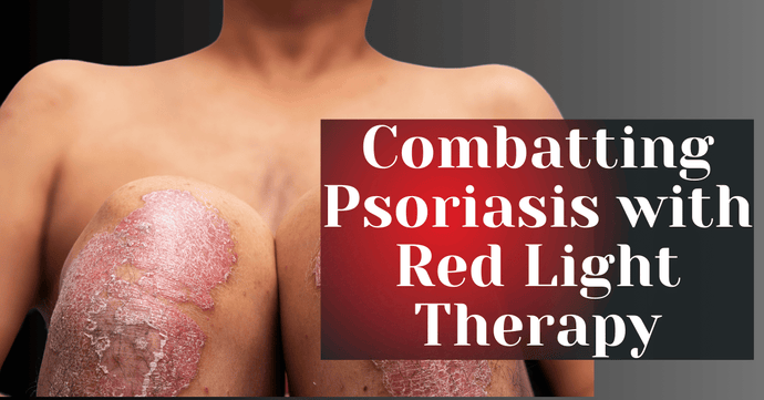 Combatting Psoriasis with Red Light Therapy