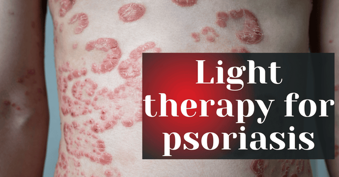 Light therapy for psoriasis