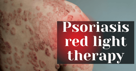 A blog featured image of psoriasis