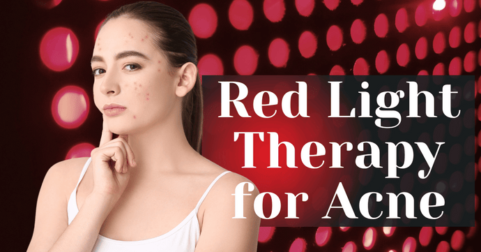 Red Light Therapy for Acne