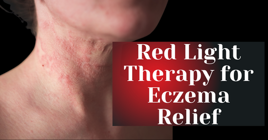 Red Light Therapy for Eczema Relief