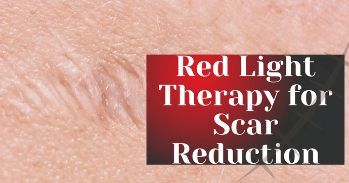 Red Light Therapy for Scar Reduction