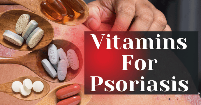 Vitamins For Psoriasis