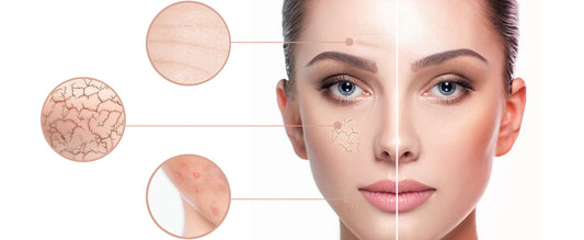 Before and after comparison of skin treated with red light therapy devices highlighting rejuvenation and repair of skin issues.